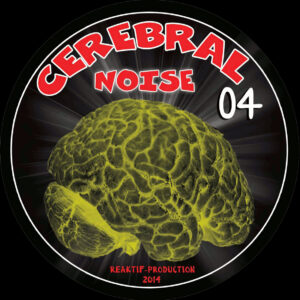 Cerebral Noise 04 - A1 Radiolog
